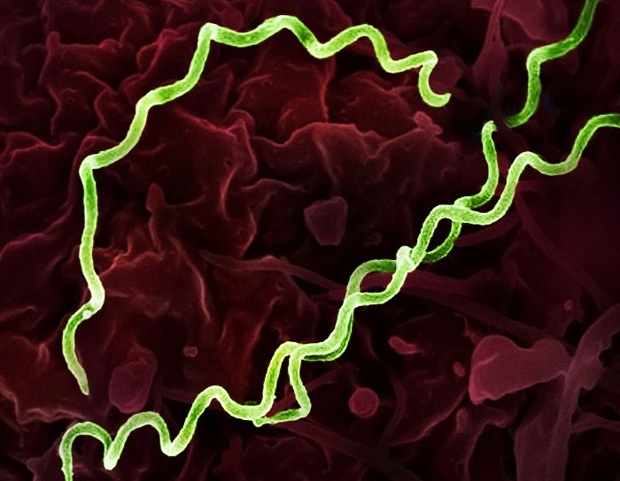 Syphilis Spikes to Levels Unseen Since 1950 in the U.S.